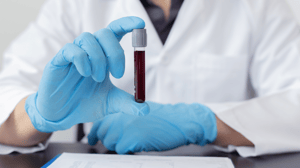 Blood Serum Viscosity